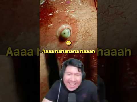 KETAWA VILLAIN BANG WINDAH 😫 #windahbasudara #brokenlore