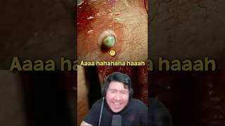 Download lagu KETAWA VILLAIN BANG WINDAH 😫 #windahbasudara #brokenlore mp3