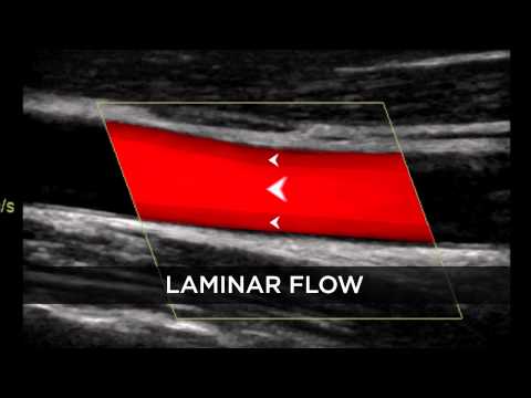 Introduction to Doppler Ultrasound