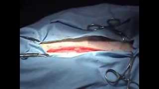 Birth of English Bulldog C section