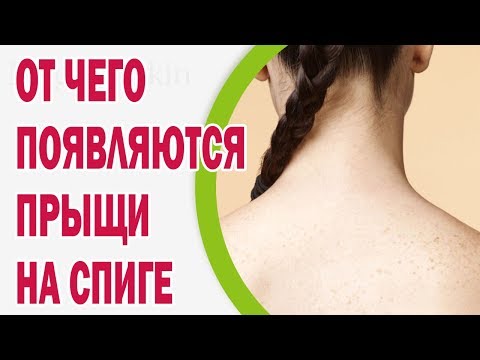 Лимфоузлы воспаление на шее за ушами лечение Лечебная гимнастика при грыже позвоночника шейного отдела