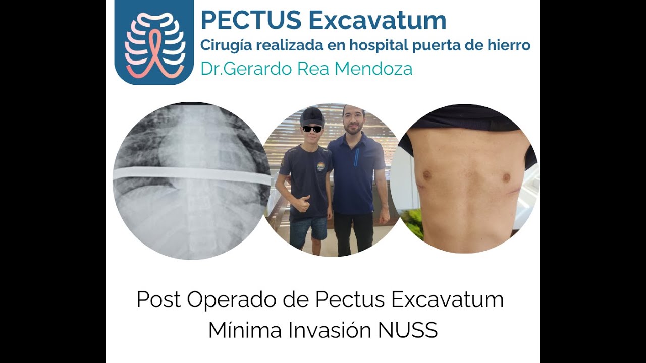 Gerardo Rea Mendoza-50