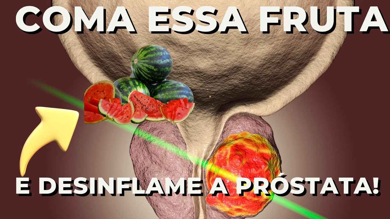 Somente uma fruta todo dia desincha sua próstata!