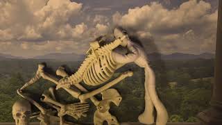 Tendinite - The bill