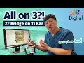 Digital Highlight All On 3 Zr Bridge On Ti Bar