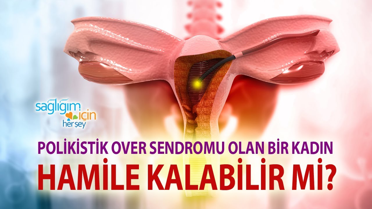 Polikistik Over Sendromu Olan Bir Kadının Adet Düzeni Nasıldır?