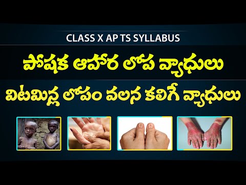 VITAMIN DEFICIENCY DISEASES in telugu  - POSHANA in telugu  - Class 10th biology  -  Eduscope 10 science
