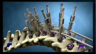 Zilnav Medical Demo Reel