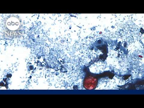 Cyclosporiasis outbreak raises new food safety concerns
