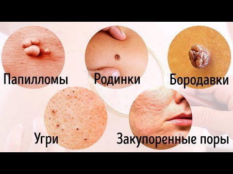 Лекарственная трава для суставов и позвоночника Пястный сустав у человека