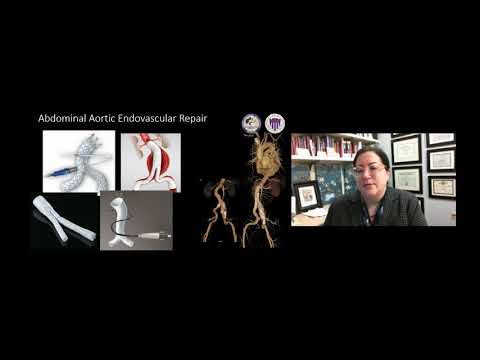 Virtual Summer Conference 2020: Vascular Complications: Types of Complications & Investigations - Dr. Sherene Shalhub