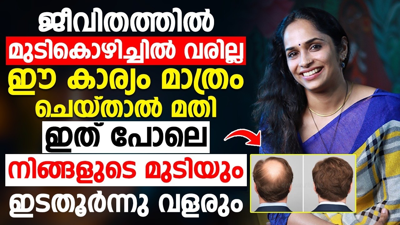 How to Prevent Hair Fall Forever: Natural Remedies and Expert Tips How to Prevent Hair Fall Forever: Natural Remedies and Expert Tips