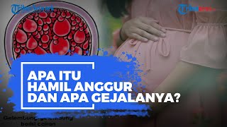 Apa Itu Hamil Anggur? Kenali Ciri-ciri dan Gejalanya Berikut Ini!