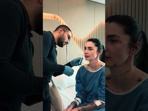 Video Oynat