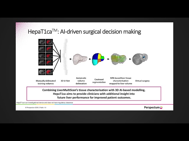 Video Pronunciation of couinaud in English