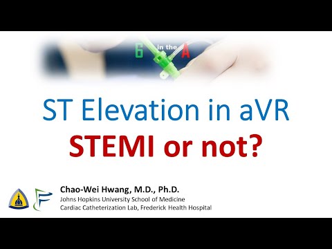 ST Elevation in aVR: STEMI or not?