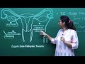 NEET Biology Assisted Reproductive Technologies Important Diagram In English By Misostudy