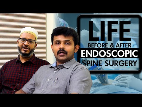 Life Before and After Endoscopic Spine Surgery - patient testimonial