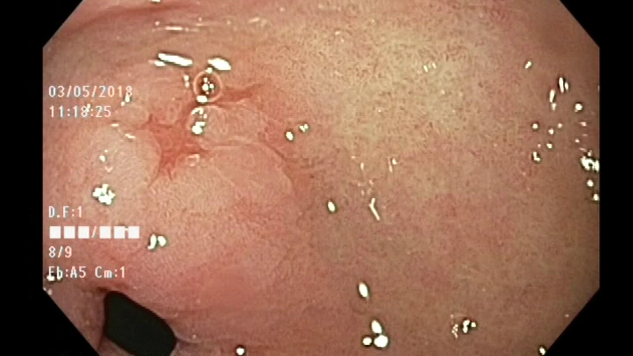 Adriana Fabiola Romano Munive-25