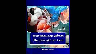 اختراق طبي في الصين بعد نجاح أول عملية زراعة كبد خنزير معدل وراثيا لرجل على قيد الحياة thumbnail