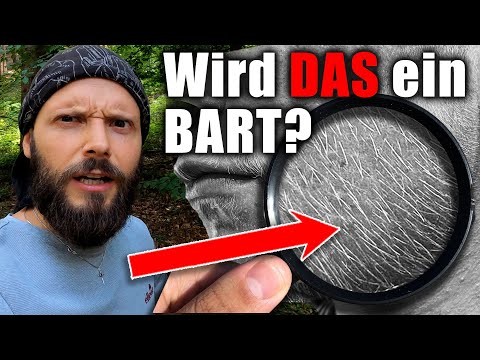 6 Monate Minoxidil ERFOLGE von FRANZ! Wann ist der BART voll ENTWICKELT?