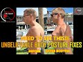 UNBELIEVABLE BODY POSTURE FIXES WITH BEFORE AND AFTER RESULTS - MUST SEE THIS!!!