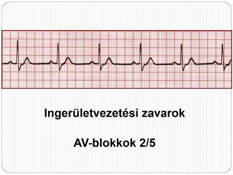 mennyi időbe telik a papillómák eltávolítása hogyan fordul elő a giardiasis a gyermekeknél?