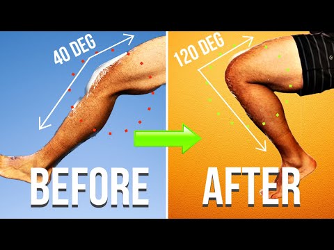 You MUST Do This After Knee Replacement!