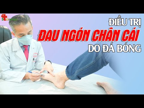 ĐAU NGÓN CHÂN CÁI do đá bóng - Điều trị thế nào? 