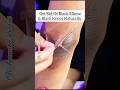 Remove Dark Elbows And Knees Remove Dark Elbows Shorts Skincare Anamika Barai