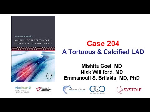 Case 204: Manual of PCI - A tortuous and calcified LAD