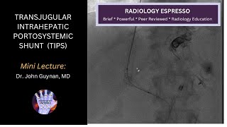 TRANSJUGULAR INTRAHEPATIC PORTOSYSTEMIC SHUNT (TIPS): Mini Lecture, Dr. John Guynan, MD