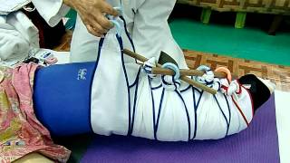 Twisting Tourniquet Technique by Paired Schnogh ขันชะเนาะ โรคบวมน้ำเหลือง