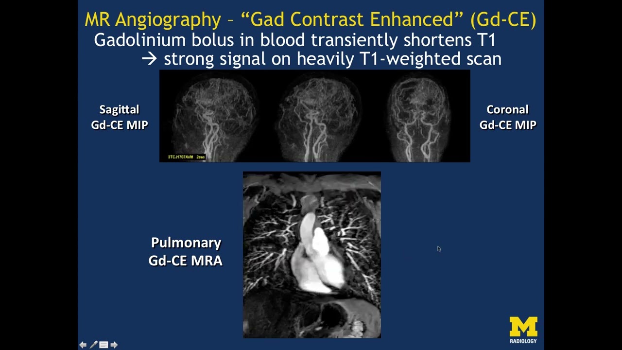 MRI Basics Part 2