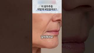 처진 볼살과 팔자주름의 생활 관리·시술 상담