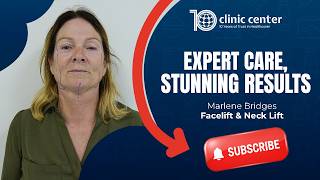 Marlene's Facelift & Neck Lift Surgeries in Turkey | Clinic Center