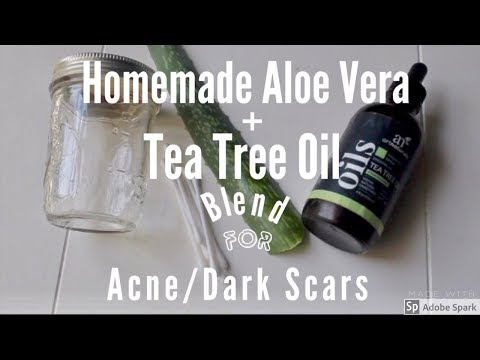 download lagu mp3 mp4 Aloe Vera And Tea Tree Oil Face Mask, download lagu Aloe Vera And Tea Tree Oil Face Mask gratis, unduh video klip Aloe Vera And Tea Tree Oil Face Mask