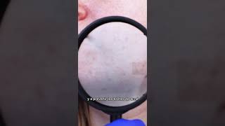video-thumb-0