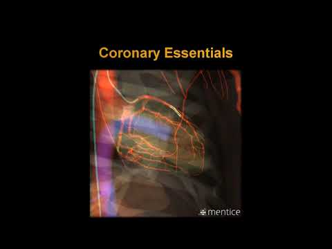 Mentice Coronary Essentials