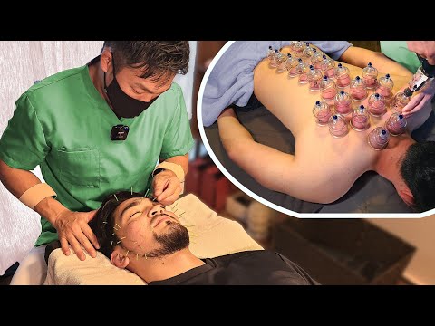 (ASMR) I Experienced Healing Cupping Therapy and Facial Acupuncture in Tokyo, Japan | Soft-Spoken