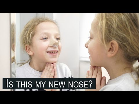 This is my new nose