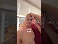 NICK WILKINS IS BALD