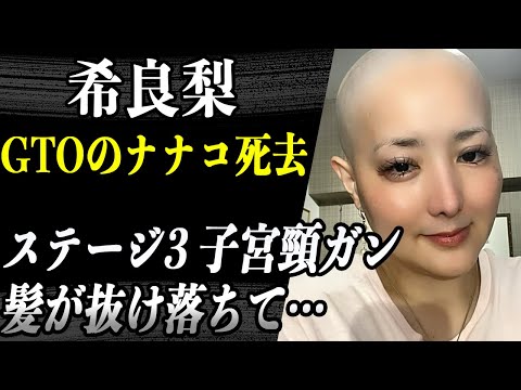 希良梨 ステージ3の子宮頸がん”で髪が抜け落ちてしまっている現在に唖然…”GTOのナナコが命を落としたその真相に驚愕…