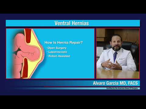 Robotic Ventral Hernia Repair, Alvaro Garcia MD