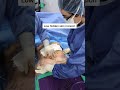 Tummy Tuck In 30 Seconds Shorts