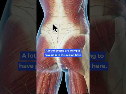 Is it SI Joint Pain or Back Pain?