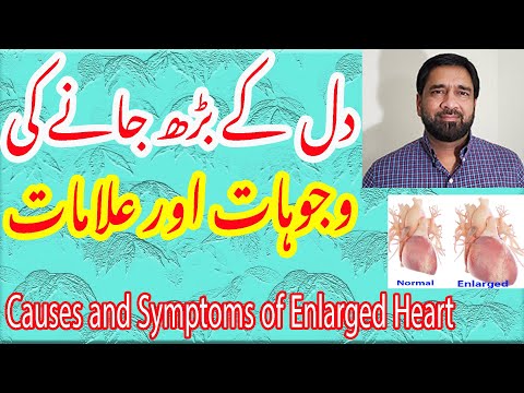 Heart Size | Signs & Symptoms of enlarged heart | Hypertrophic Heart | Normal Heart in Urdu