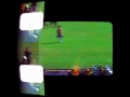 JFK Assassination : The Zapruder Film - Frames 313 ...