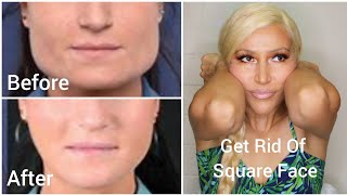 How To Get Rid Of Square Face Shape Naturally | Reshape & Slim Square Jaw Into Oval Face Exercise