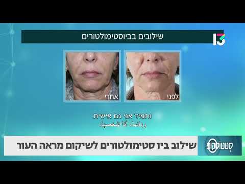 שילוב ביו סטימולטורים לשיקום מראה העור
